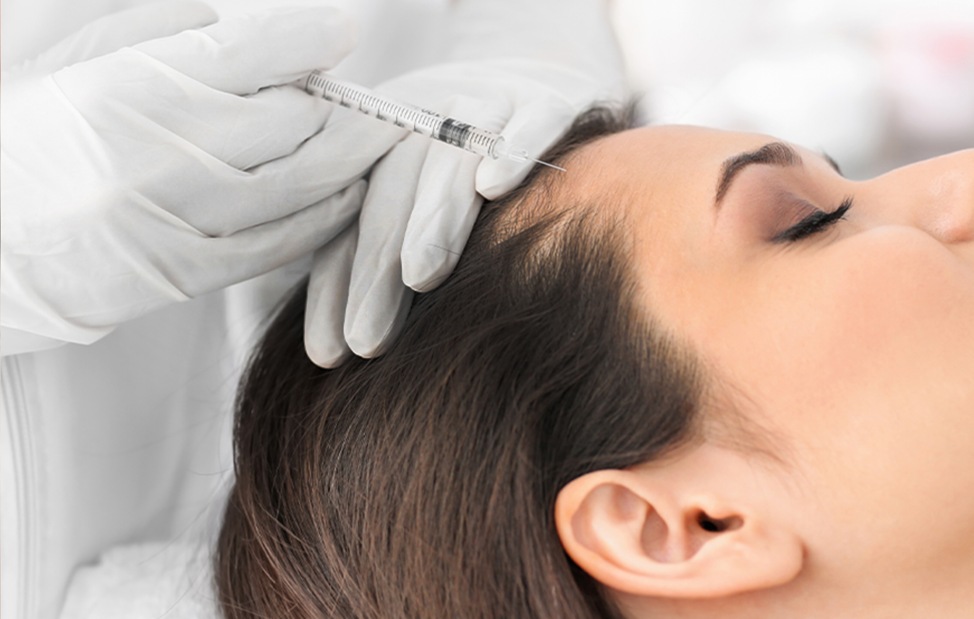 Mesotherapy Treatment
