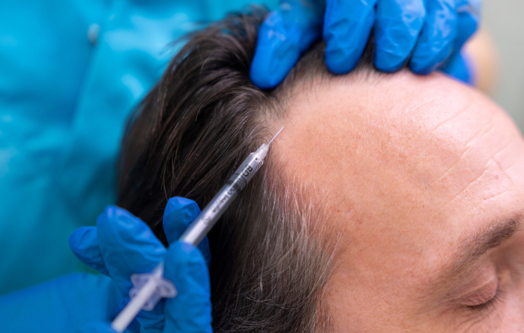 Stem Cell Therapy